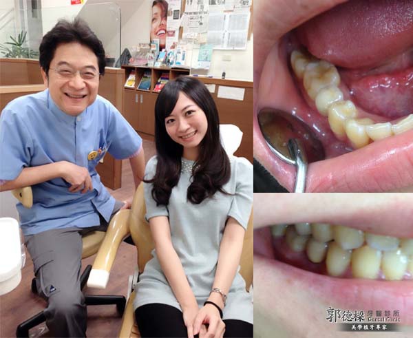 定期口腔檢查，及早治療牙齒問題，人工植牙提高生活便利性